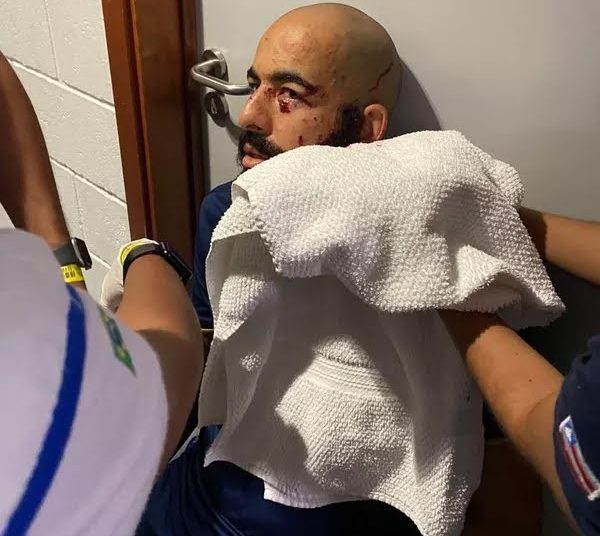 Ônibus do Bahia é atingido por bomba na Fonte Nova, antes de pegar o Sampaio; jogadores ficam feridos